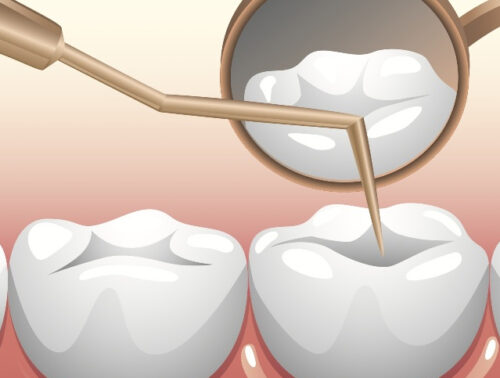 odontoterapie-restauratoare